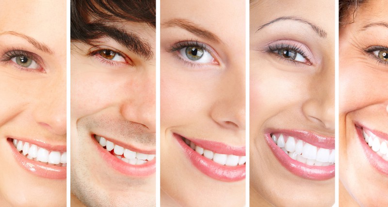 Sorrisi prima e dopo